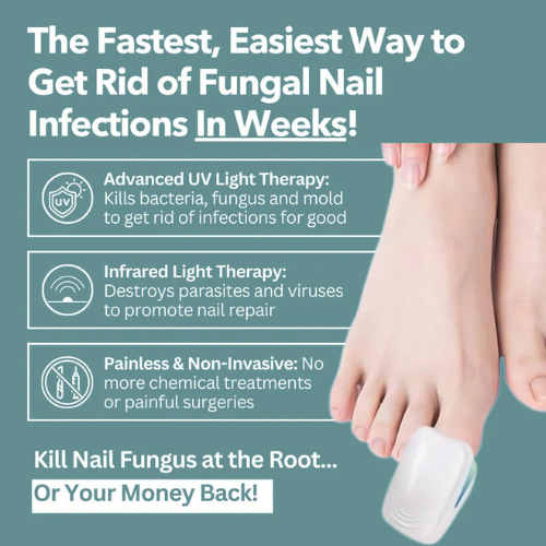Onars Pro™ - Nail Fungus Laser Device