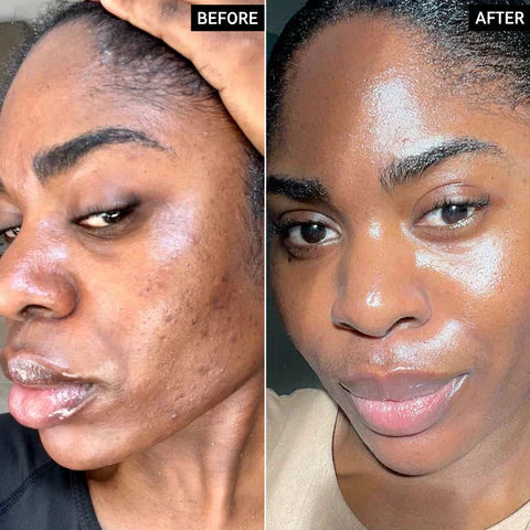 Radiant Glow Duo Peeling Kit